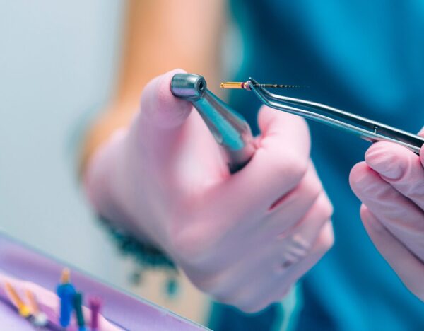 Root Canal Treatments