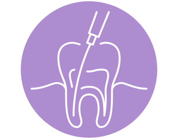 Root Canals
